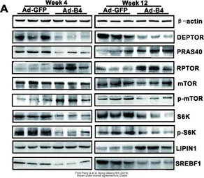 Anti-p70 S6K antibody used in Western Blot (WB). GTX107562