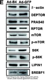 Anti-p70 S6K antibody used in Western Blot (WB). GTX107562