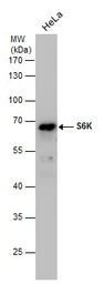 Anti-p70 S6K antibody used in Western Blot (WB). GTX107562