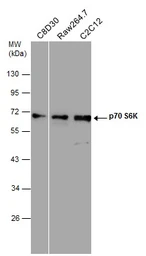 Anti-p70 S6K antibody used in Western Blot (WB). GTX107562