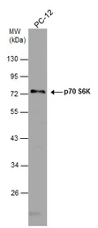 Anti-p70 S6K antibody used in Western Blot (WB). GTX107562