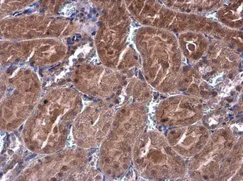 Anti-p70 S6K antibody used in IHC (Paraffin sections) (IHC-P). GTX107562