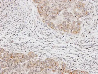 Anti-p70 S6K antibody used in IHC (Paraffin sections) (IHC-P). GTX107562