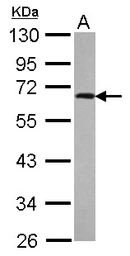 Anti-p70 S6K antibody used in Western Blot (WB). GTX107562