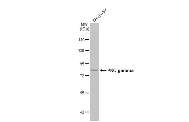 Anti-PKC gamma antibody used in Western Blot (WB). GTX107639