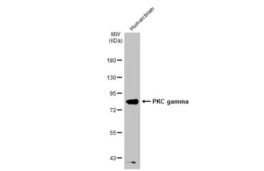 Anti-PKC gamma antibody used in Western Blot (WB). GTX107639