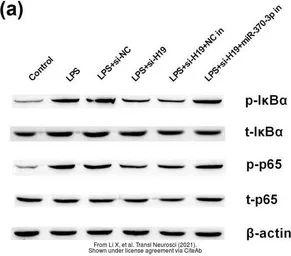 Anti-NFkB p65 antibody used in Western Blot (WB). GTX107678