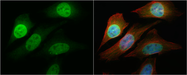 Anti-NFkB p65 antibody used in Immunocytochemistry/ Immunofluorescence (ICC/IF). GTX107678