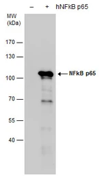 Anti-NFkB p65 antibody used in Western Blot (WB). GTX107678