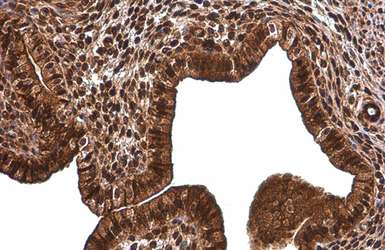 Anti-NFkB p65 antibody used in IHC (Paraffin sections) (IHC-P). GTX107678