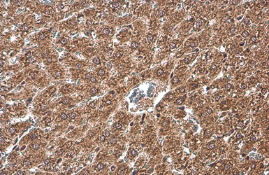 Anti-NFkB p65 antibody used in IHC (Paraffin sections) (IHC-P). GTX107678