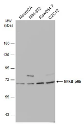 Anti-NFkB p65 antibody used in Western Blot (WB). GTX107678