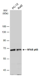 Anti-NFkB p65 antibody used in Western Blot (WB). GTX107678