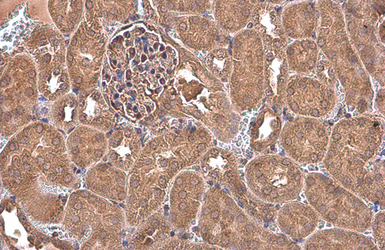 Anti-NFkB p65 antibody used in IHC (Paraffin sections) (IHC-P). GTX107678