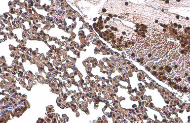 Anti-NFkB p65 antibody used in IHC (Paraffin sections) (IHC-P). GTX107678