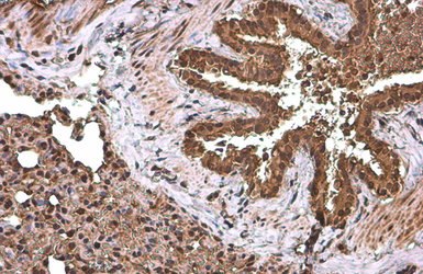 Anti-NFkB p65 antibody used in IHC (Paraffin sections) (IHC-P). GTX107678