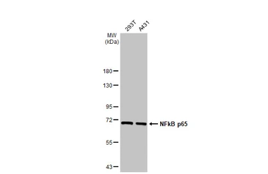 Anti-NFkB p65 antibody used in Western Blot (WB). GTX107678