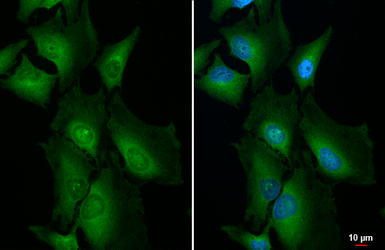 Anti-NFkB p65 antibody used in Immunocytochemistry/ Immunofluorescence (ICC/IF). GTX107678