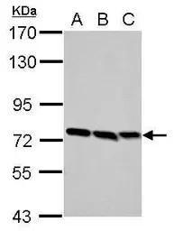 Anti-FNBP1 antibody [N1N2], N-term used in Western Blot (WB). GTX107688