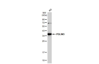 Anti-ALP / PDLIM3 antibody [C2C3], C-term used in Western Blot (WB). GTX107697