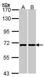 Anti-RIC8A antibody used in Western Blot (WB). GTX107712