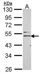 Anti-Nogo Receptor antibody [N2N3] used in Western Blot (WB). GTX107717