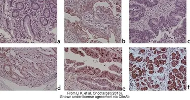 Anti-ZNF703 antibody used in IHC (Paraffin sections) (IHC-P). GTX107721