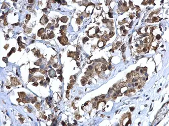 Anti-ZNF703 antibody used in IHC (Paraffin sections) (IHC-P). GTX107721