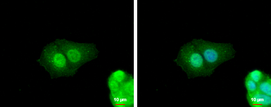 Anti-ZNF703 antibody used in Immunocytochemistry/ Immunofluorescence (ICC/IF). GTX107721