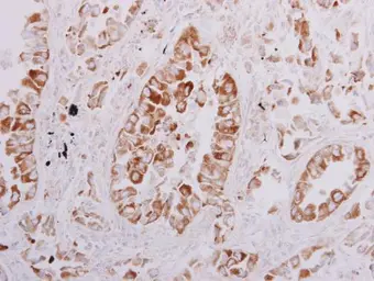 Anti-OSBPL6 antibody [C3], C-term used in IHC (Paraffin sections) (IHC-P). GTX107723