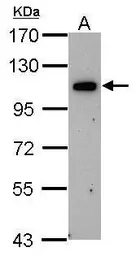 Anti-OSBPL6 antibody [C3], C-term used in Western Blot (WB). GTX107723