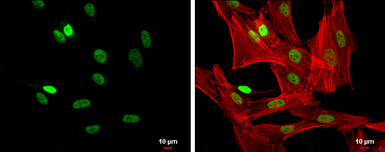 Anti-FOXP3 antibody [C3], C-term used in Immunocytochemistry/ Immunofluorescence (ICC/IF). GTX107737