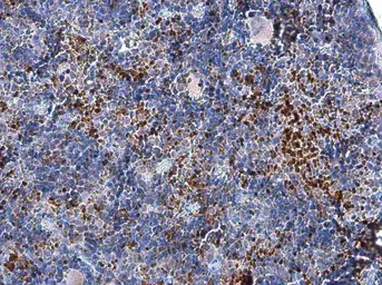 Anti-FOXP3 antibody [C3], C-term used in IHC (Paraffin sections) (IHC-P). GTX107737