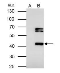 Anti-FOXP3 antibody [C3], C-term used in Immunoprecipitation (IP). GTX107737