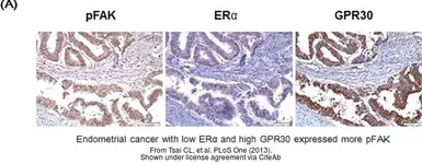 Anti-GPR30 antibody [C2C3], C-term used in IHC (Paraffin sections) (IHC-P). GTX107748