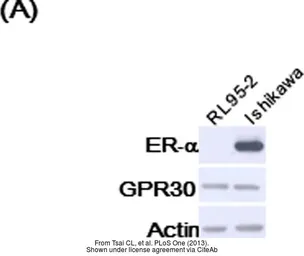 Anti-GPR30 antibody [C2C3], C-term used in Western Blot (WB). GTX107748