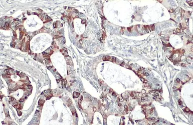 Anti-GPR30 antibody [C2C3], C-term used in IHC (Paraffin sections) (IHC-P). GTX107748