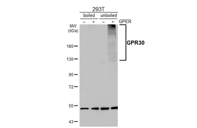 Anti-GPR30 antibody [C2C3], C-term used in Western Blot (WB). GTX107748