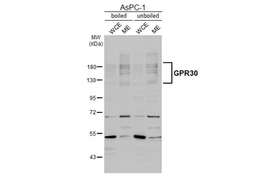 Anti-GPR30 antibody [C2C3], C-term used in Western Blot (WB). GTX107748