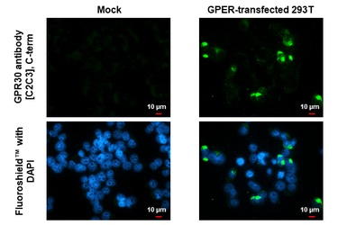 Anti-GPR30 antibody [C2C3], C-term used in Immunocytochemistry/ Immunofluorescence (ICC/IF). GTX107748