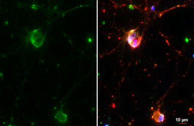 Anti-GPR30 antibody [C2C3], C-term used in Immunocytochemistry/ Immunofluorescence (ICC/IF). GTX107748