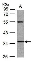 Anti-PANK3 antibody used in Western Blot (WB). GTX107798