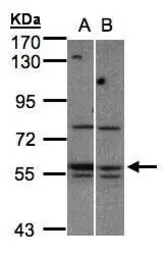 Anti-MST3 antibody [N3C3-2] used in Western Blot (WB). GTX107834