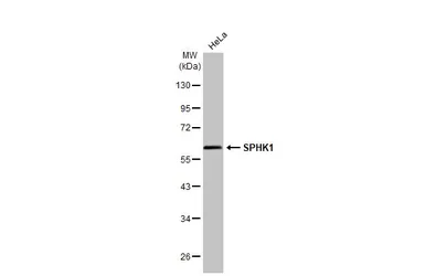 Anti-SPHK1 antibody used in Western Blot (WB). GTX107843