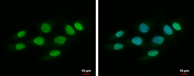 Anti-SPHK1 antibody used in Immunocytochemistry/ Immunofluorescence (ICC/IF). GTX107843