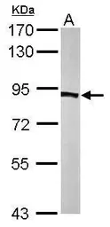 Anti-PFKP antibody [N3C3] used in Western Blot (WB). GTX107857