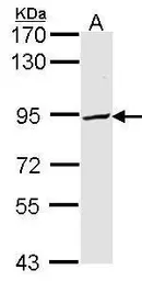 Anti-PFKP antibody [N3C3] used in Western Blot (WB). GTX107857