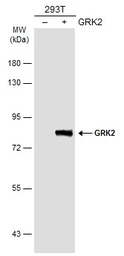 Anti-GRK2 antibody [N3C3-2] used in Western Blot (WB). GTX107915