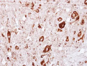 Anti-GRK2 antibody [N3C3-2] used in IHC (Paraffin sections) (IHC-P). GTX107915