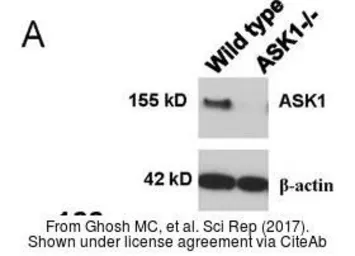 Anti-ASK1 antibody [C2C3-2], C-term used in Western Blot (WB). GTX107921